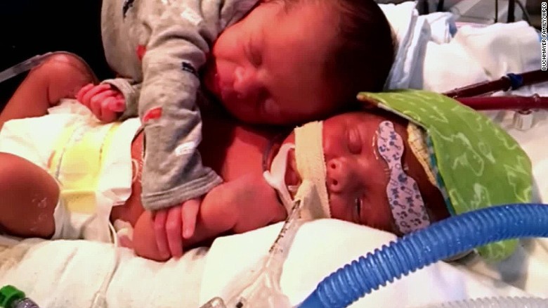Desgarradora foto de gemelos recién nacidos abrazados se vuelve viral | CNN