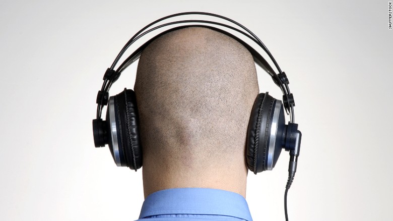¿Qué es la alopecia, cuáles son sus causas y cómo se puede tratar?