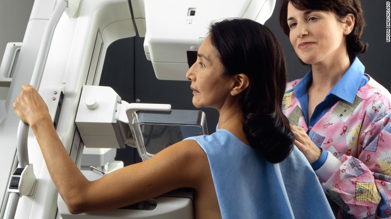 Hay expertos que recomiendan hacerse las mamografías no de manera anual sino cada dos años, y a partir de los 50 años.
