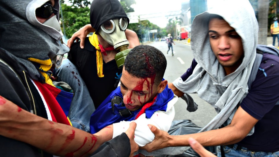 An injured opposition activist is carried by fellow demonstrators during clashes with riot police during a protest march in Caracas on April 26, 2017. Protesters in Venezuela plan a high-risk march against President Maduro Wednesday, sparking fears of fresh violence after demonstrations that have left 26 dead in the crisis-wracked country. / AFP PHOTO / RONALDO SCHEMIDT (Photo credit should read RONALDO SCHEMIDT/AFP/Getty Images)