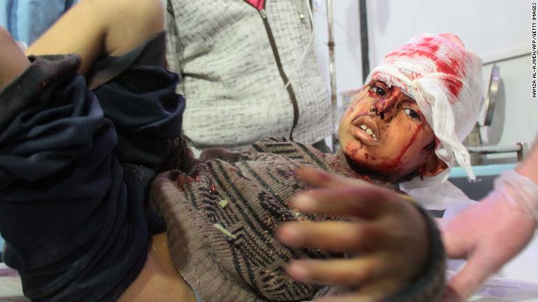 Un niño herido recibe tratamiento en Douma después de bombardeos en el pueblo de Mesraba.