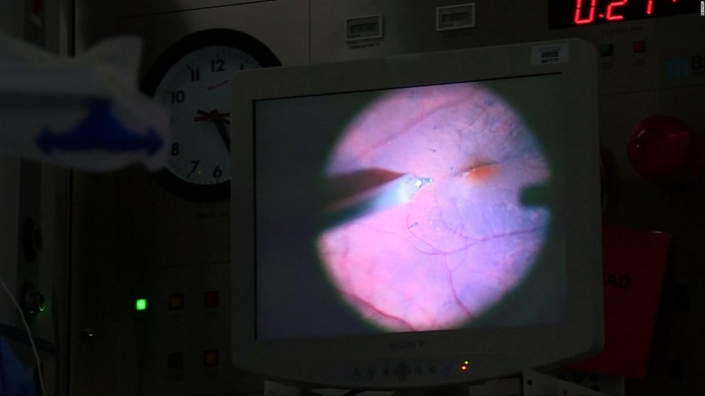 Un robot participa en su primera cirugía de retina