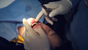 América Latina a la vanguardia en tratamientos de ortodoncia