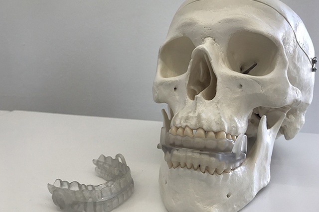 El dispositivo bucal creado para prevenir la apnea del sueño se produce en impresora 3D