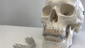 El dispositivo bucal creado para prevenir la apnea del sueño se produce en impresora 3D