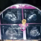 La familia mostró imágenes de la ecografía durante el embarazo. (Crédito: fotografía cedida por el diario Crónica).