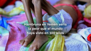 #MinutoCNN: Yemen enfrenta la peor hambruna de su historia