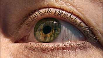 ¿Cómo prevenir la retinopatía diabética?