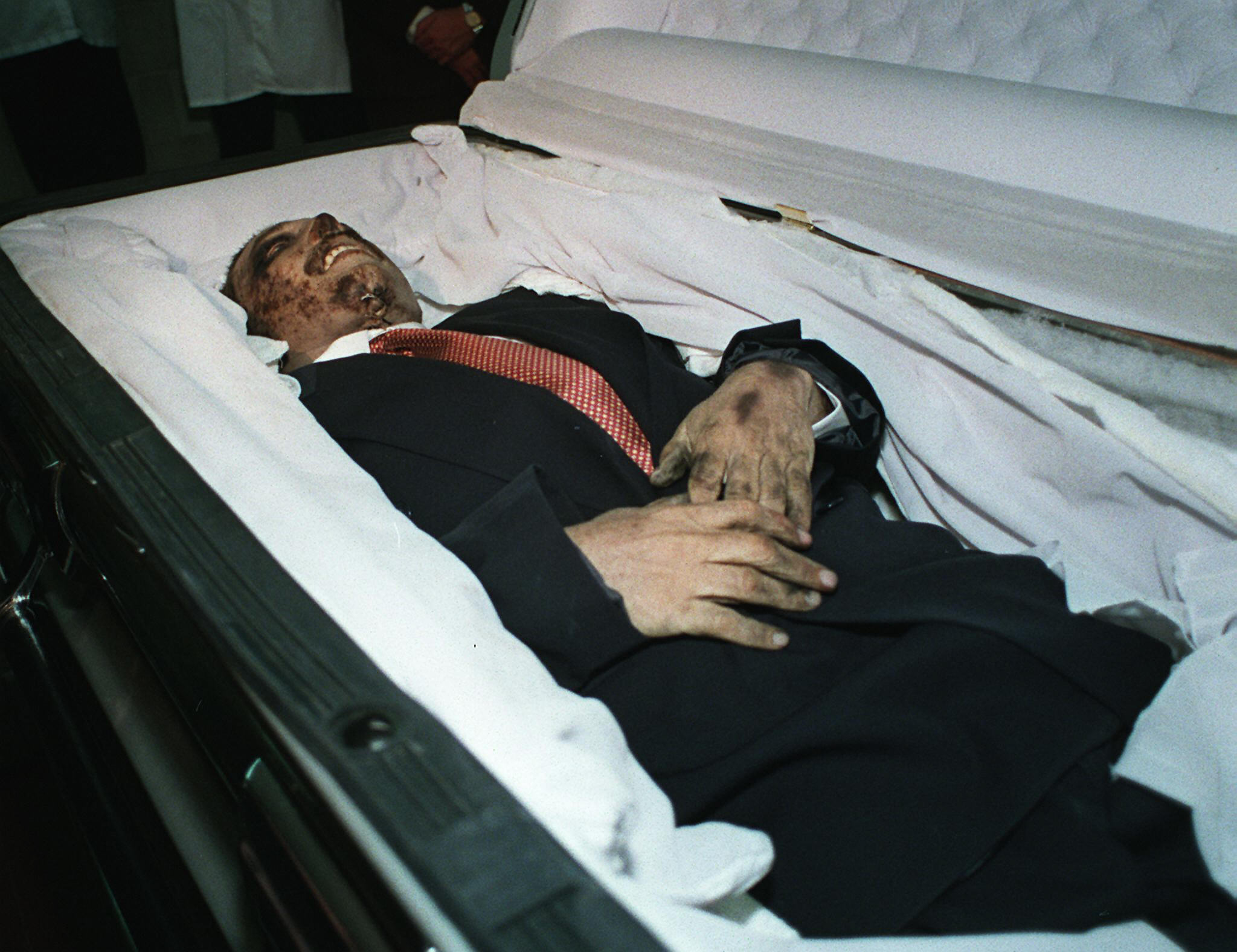 , considered Mexico's most powerful drug lord and head of the Juarez drug cartel, 07 July at a morgue in Mexico City. US anti-drug officials confirmed that Carrillo Fuentes had died of a heart attack 04 July while undergoing plastic surgery and liposuction to alter his appearance. The Mexican government has not issued a confirmation on the identity of the body but the US State department announced 07 July that US drug agents said the body had been positively identified. AFP PHOTO/Omar TORRES (Photo credit should read OMAR TORRES/AFP/Getty Images)