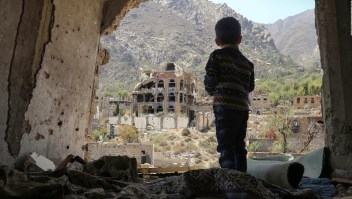 El hambre en Yemen golpea a los más pequeños