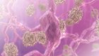 Nuevos datos sobre el Alzheimer y la vacuna contra la gripe