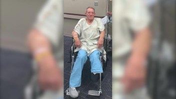 Granjero sacrifica su pierna para salvar la vida