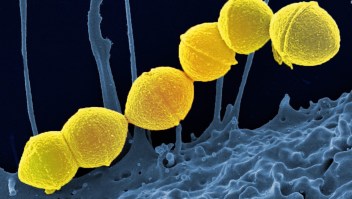 Lo que debes saber sobre la bacteria comecarne