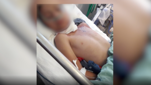 El menor sobrevivió a una fuerte herida en el cuello; un corte de 7 centímetros y un orificio, dijo Hernandez. El menor fue atendido en la emergencia del Hospital General de Cautla, Morelos.