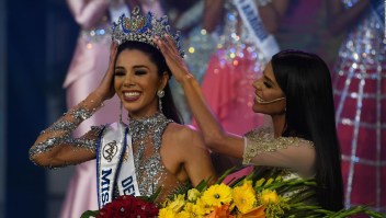 El nuevo patrón de belleza del Miss Venezuela