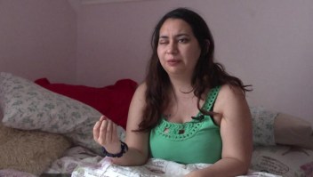 Joven pierde su ojo por impacto de perdigón en Chile