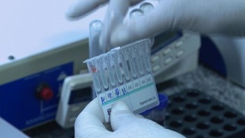 3.800 personas prueban vacuna contra el VIH en ocho países