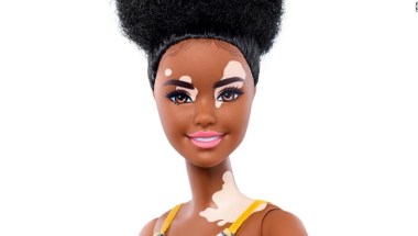 recuerdos Envío Refinar Barbie lanza muñecas con vitiligo y sin cabello en una apuesta por  fortalecer la diversidad | CNN