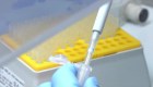 ¿Es posible autorrealizarse la prueba del coronavirus?