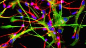 El proceso que convierte a las células madre en neuronas