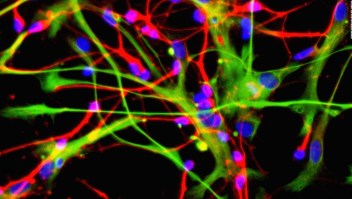 El proceso que convierte a las células madre en neuronas