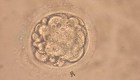 Crear óvulos y espermas en laboratorio, ¿mito o realidad?