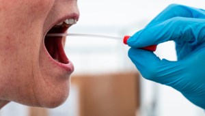 saliva prueba boca coronavirus