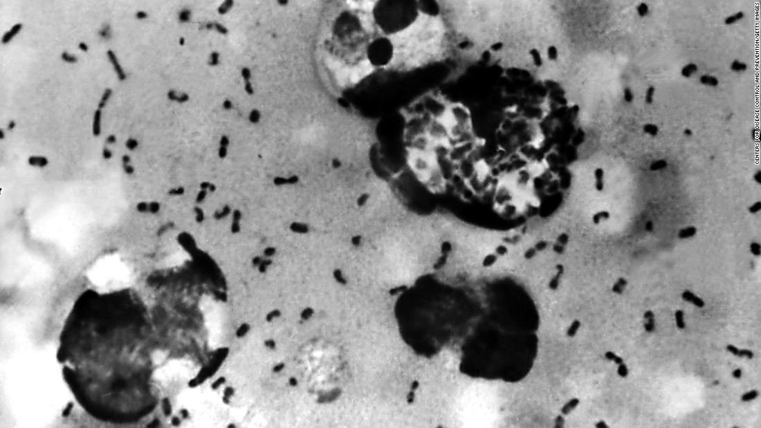 ¿Por qué la peste todavía existe en 2020? ¿Corres el riesgo de contagiarte?