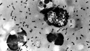 ¿Por qué la peste todavía existe en 2020? ¿Corres el riesgo de contagiarte?