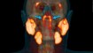 Posible nuevo órgano en la garganta humana descubierto por científicos holandeses