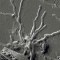 Científicos encuentran células cerebrales intactas en el cráneo de un hombre muerto en la erupción del Vesubio hace casi 2.000 años