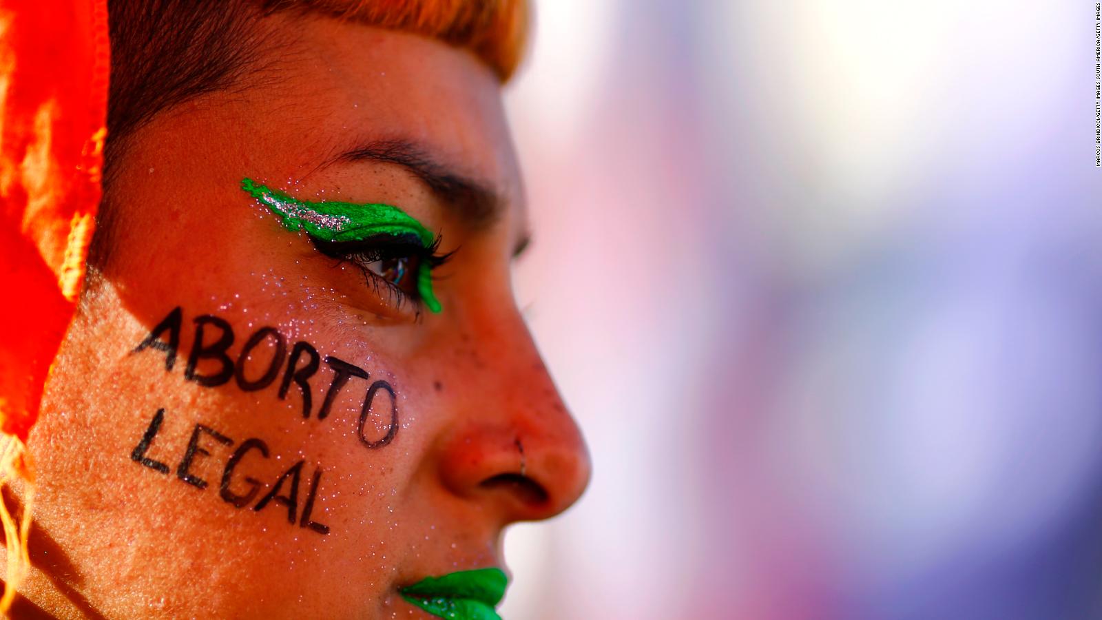 Only 3 countries in Latin America allow voluntary abortion |  Video