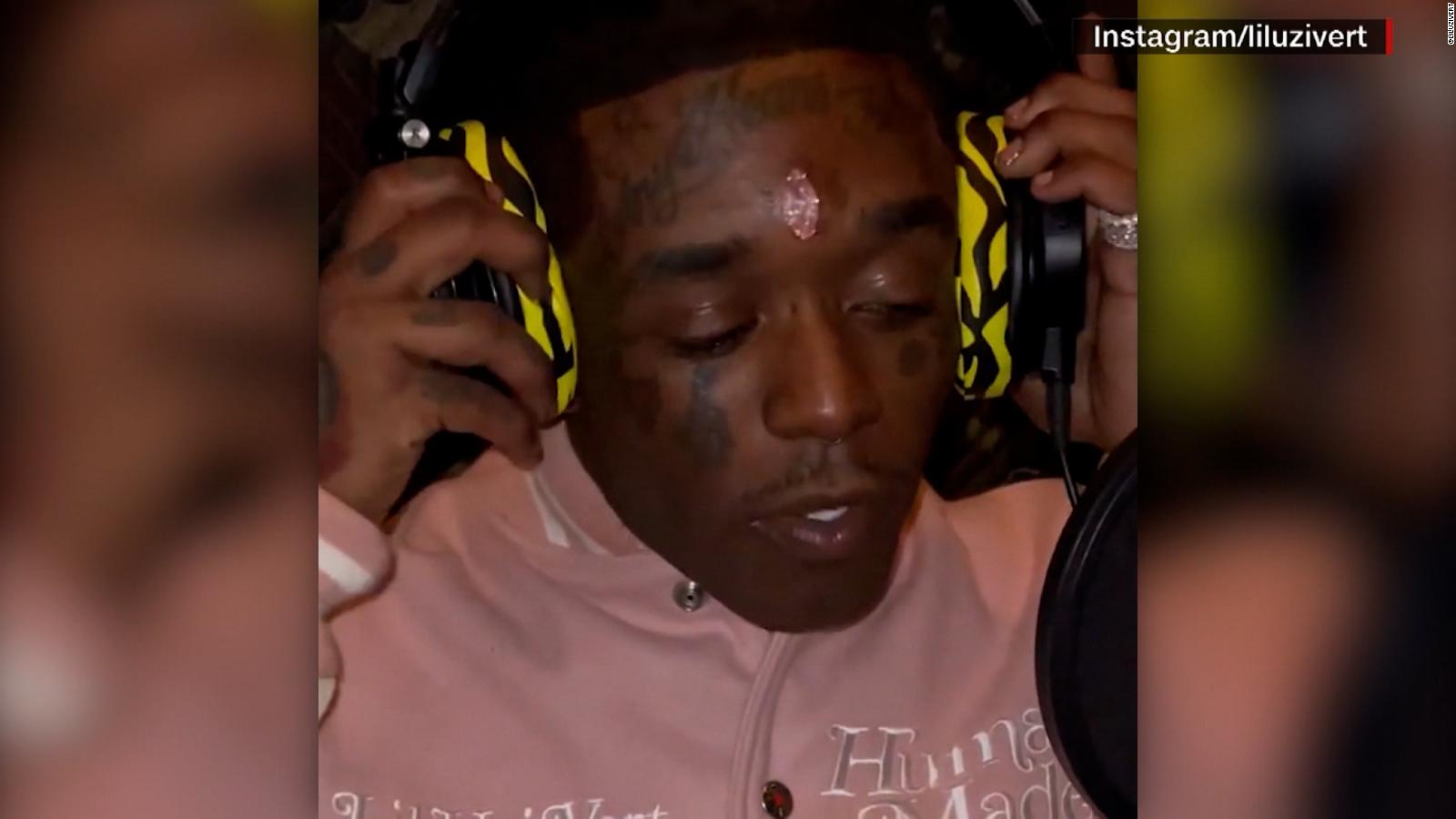 The rapper Lil Uzi Vert implants a diamond in the front |  Video