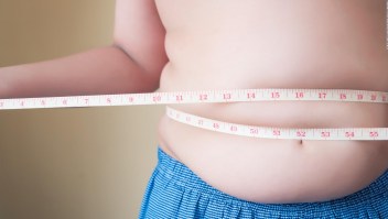 3 claves para combatir la obesidad, según especialista