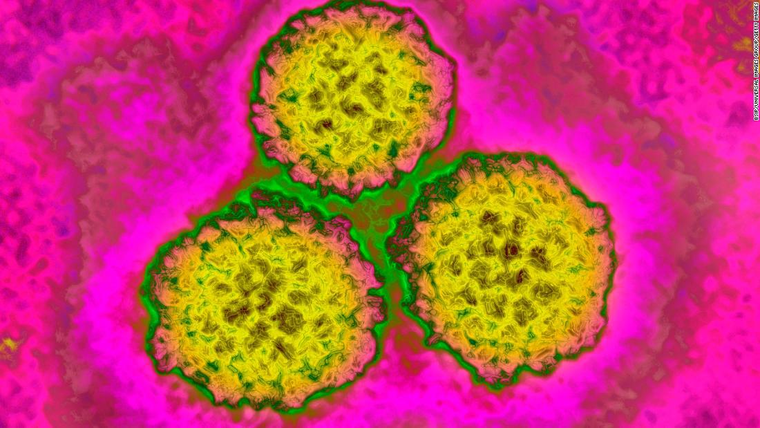 Papilloma virus microbiologia, Glande con papiloma virus