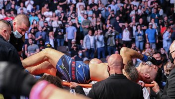 UFC: así luce la pierna de Chris Weidman tras operación