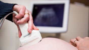 Maravilla médica: mujer queda embarazada mientras ya estaba embarazada
