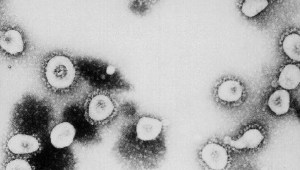 Por qué los virus son esenciales para la vida