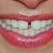 Estas 5 costumbres pueden estropear tus dientes