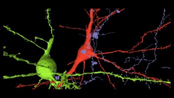 Así se ven nuestras neuronas con un poco de color
