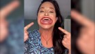 Mujer con la boca más grande del mundo, según Guinness