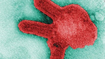 Caso del virus de Marburgo en Guinea, ¿de qué se trata?