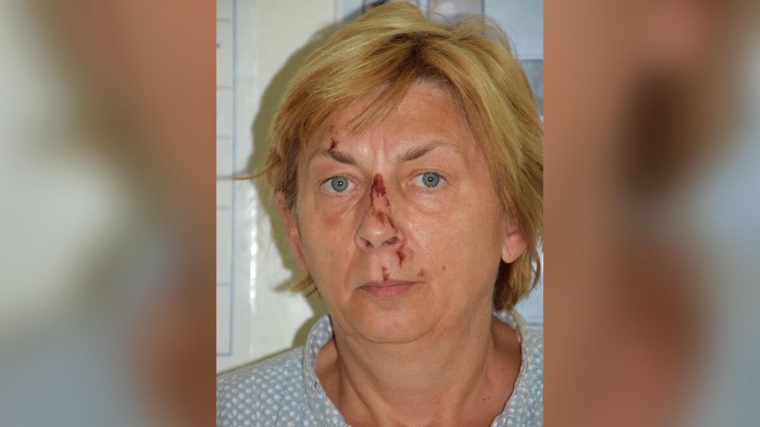 They found a wounded woman in Croatia who did not remember who she was or how she got there