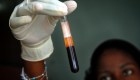 ¿Puede "curarse" alguien del VIH sin tratamientos?