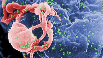 La mujer fue diagnosticada con VIH en 2013