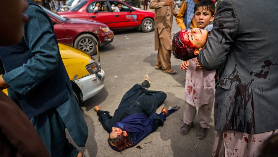17 de agosto: un hombre lleva a un niño ensangrentado mientras una mujer herida yace en la calle después de que los combatientes talibanes dispararan armas de fuego y arremetieran con látigos, palos y objetos punzantes para controlar a una multitud a las afueras del aeropuerto en Kabul, Afganistán. (Crédito: Marcus Yam/Los Angeles Times/Shutterstock)