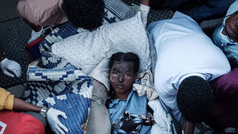 Foto de un herido tras ataque aéreo en Etiopía