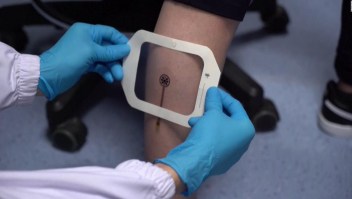 Ahora puedes monitorear tus heridas con una app