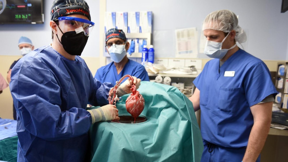 Médicos trasplantan un corazón de cerdo en un humano