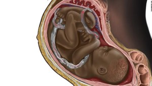 ilustracion feto negro